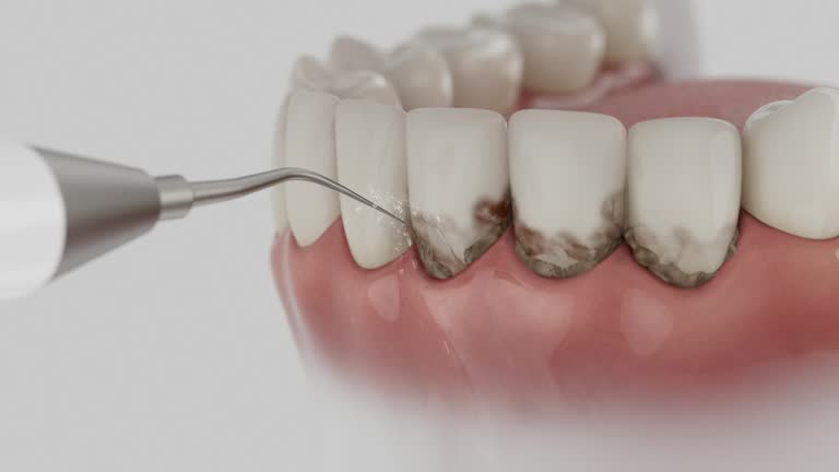 Reliable Dental Implants contractor in Elberta, AL by Smile Center Dentistry